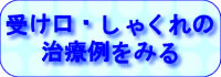 受け口・しゃくれの治療例をみる
