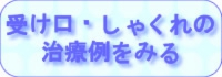 受け口・しゃくれの治療例をみる